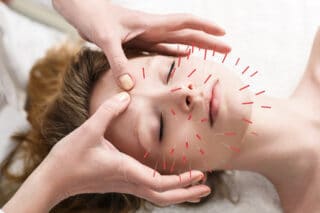 Acupuncture and Allergy Relief