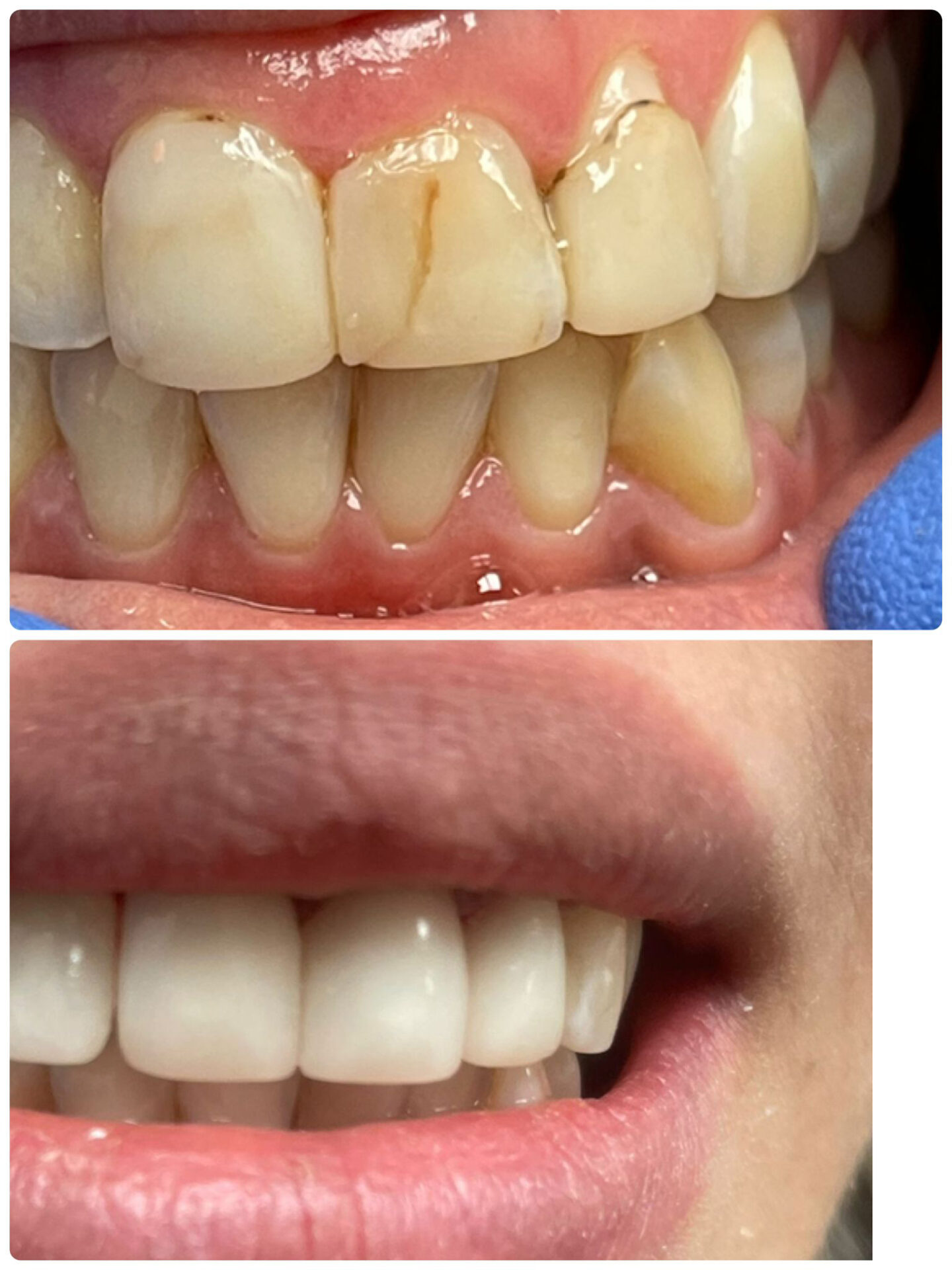 What Is CEREC In Dentistry? Your Health Magazine