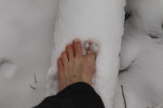 Diabetic Foot and Frostbite