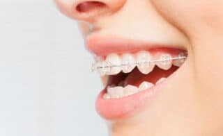 How Teeth Affect Facial Aesthetics