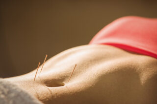 Acupuncture  For PCOS