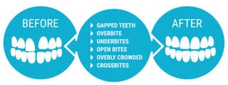 Commonly Treated Orthodontic Problems
