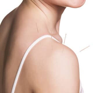 Chinese Acupuncture For Shoulder Pain