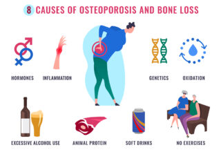 Prevent and Treat Osteoporosis