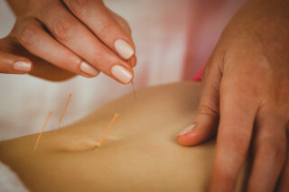 Chinese Acupuncture For Infertility