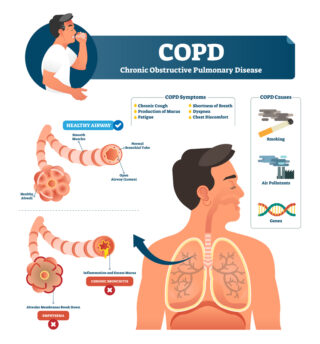 COPD: Making Breathing Difficult For Millions of Americans