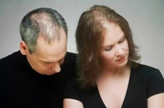 <strong>Hair Loss: How Is It Affecting Your “Sex Life”?</strong>