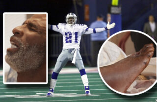Deion Sanders has “Time Bomb in His Leg” ­– Loses 2 Toes