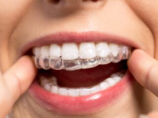 <strong>Why Choose Invisalign<sup>®</sup>?</strong>