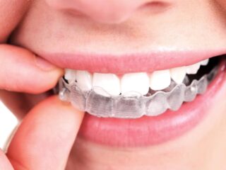 Straighten Your Teeth, Improve Your Health