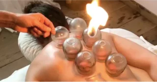 Fire Cupping – Your Friendly, Needle-Free Pain Reliever
