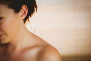 <strong>Acupuncture: How to Unlock a Frozen Shoulder, Reducing Pain, and Improving Performance</strong>