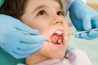 Navigating Orthodontic Care in Children: A Pediatric Dentist’s Guide