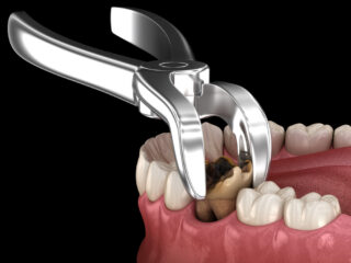 <strong>Comprehensive Dental Health</strong>