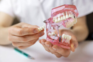 <strong>Implant Vs Bridge: Choosing The Right Restorative Dentistry Procedure </strong>