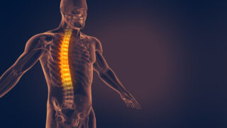 <strong>Understanding Cervical Spine Disorders</strong>