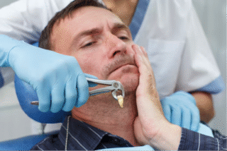 How Long Does It Really Take to Heal After Wisdom Teeth Removal? Myths vs Reality?
