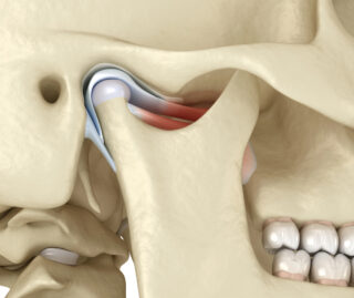Innovative Treatments for TMJ
