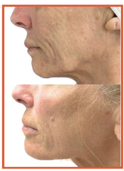 World-recognized leaders in aesthetics and lasers