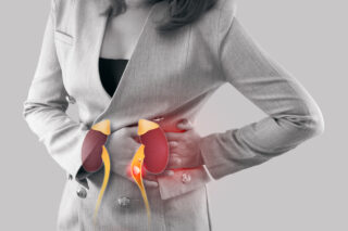 How To Find the Best Kidney Stone Specialist