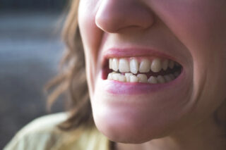 Crooked Teeth, Hidden Risks