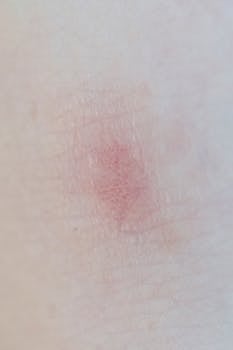 What You Need to Know About Managing MCAS Rash Symptoms