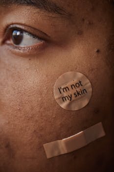 Can Tretinoin Effectively Reduce Acne Scars?