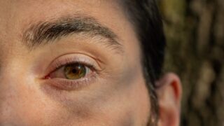 Do Blue Eyes Experience Greater Sensitivity to Light?