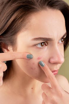 Decoding Chin Acne: Causes and What Your Pimples Might Mean