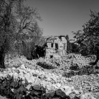 Recognizing the Signs of a Lung Collapse: What to Look For