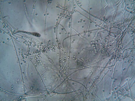Is It Safe to Have Sex When You Have a Yeast Infection? - Your Health Magazine Is It Safe to Have Sex When You Have a Yeast Infection? - Your Health Magazine