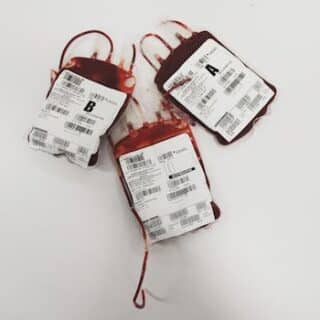 Essential Insights About A- Blood Type and Its Unique Characteristics