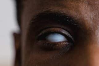 Stye or Pink Eye: How to Identify and Treat These Common Eye Conditions