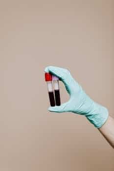 What the Aldolase Blood Test Reveals About Your Health