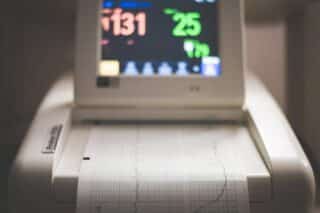 How NST Fetal Monitoring Can Enhance Pregnancy Care