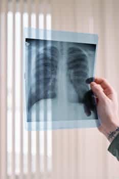Enhancing Lung Health Through Effective Pulmonary Hygiene Practices