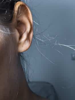 Could Hormone Replacement Therapy Provide Relief for Your Tinnitus?