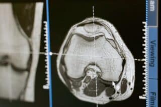 Can You Eat Before an MRI? Discover the Guidelines for Your Scan
