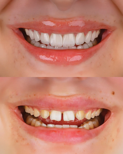 Your Best Smile. Without the Wait. - Your Health Magazine