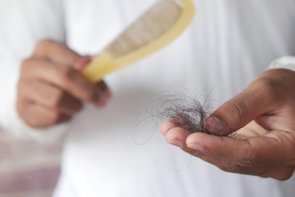 An image showing hair loss with a comb in hand.